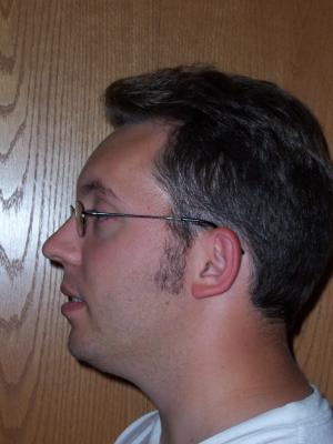 Side view - no facial hair